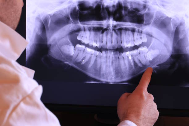 Best Emergency Care for Gum Disease in Cortland, IL